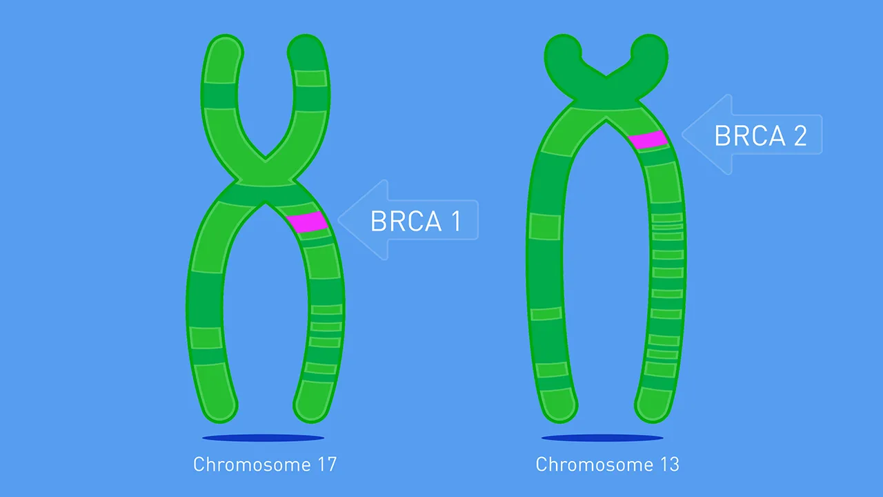 BRCA1-BRCA2-FAMILIARITA-E-TUMORE-AL-SENO-DOTT-MAURIZIO-BRUNO-NAVA-CHIRURGO-MILANO