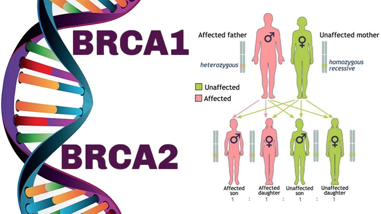 LA-MUTAZIONE-BRCA-PUO-INFLUENZARE-IL-MIO-PERCORSO-DI-CURA-DOTT-MAURIZIO-NAVA-CHIRURGO-TUMORE-SENO-MILANO