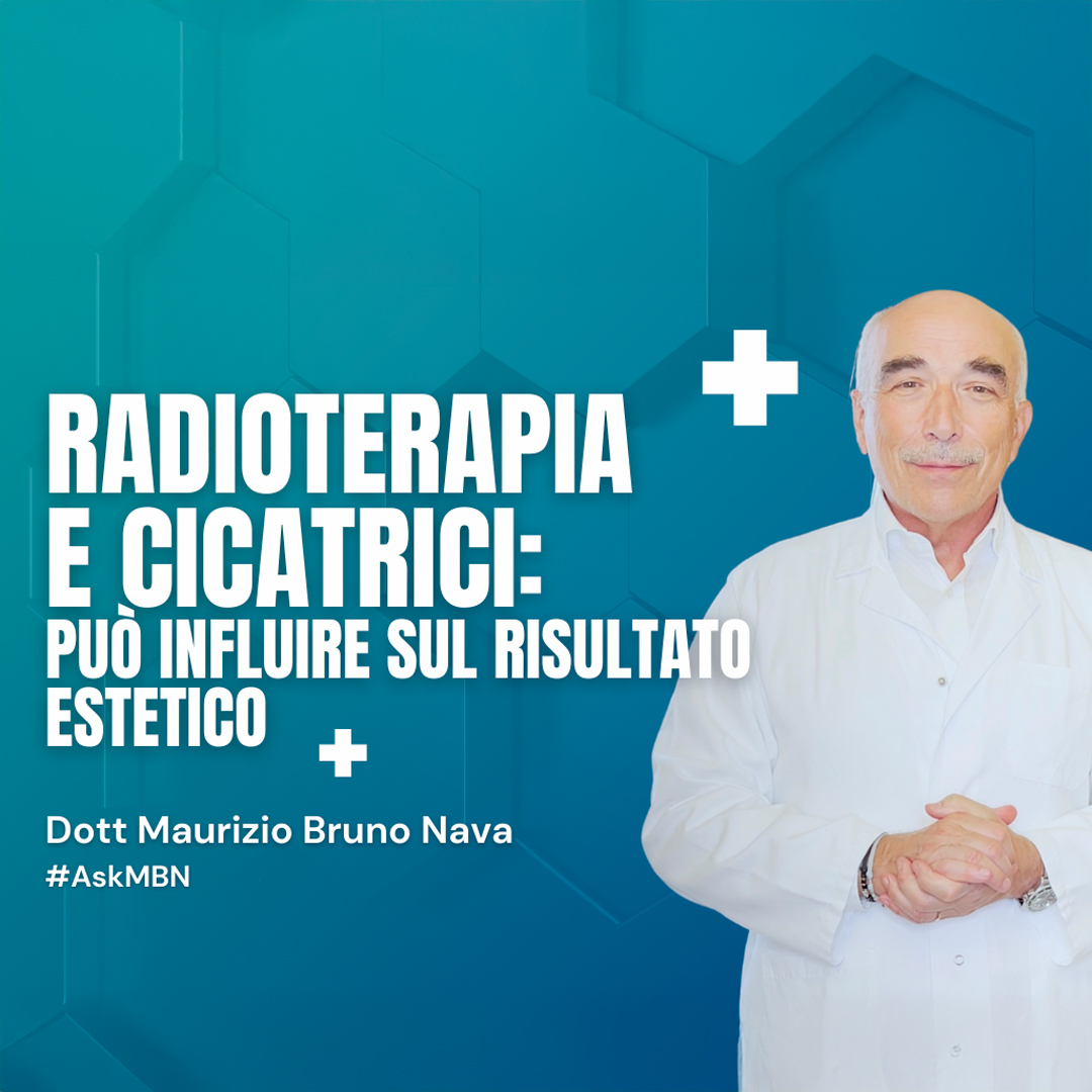 RADIOTERAPIA-E-CICATRICI-PUO-INFLUIRE-SUL-RISULTATO-ESTETICO-DOTT-MAURIZIO-BRUNO-NAVA-CHIRURGO-MILANO